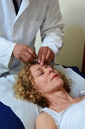 Acupuncture